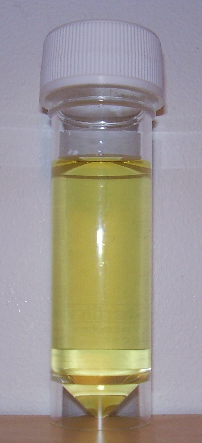 Urine Why Is It Yellow Consider Its Source